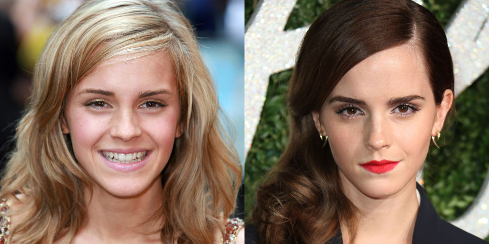 18 Celebs Who Look Equally Flawless With Blonde And Brunette Hair Emma Watson